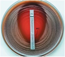 E test for MIC determination