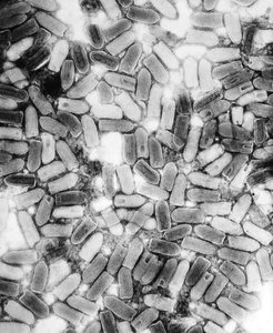 Electron micrograph of rabies virus particles