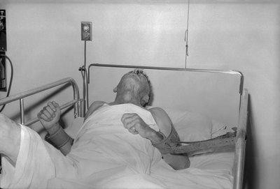 Rabies patient with neurological symptoms