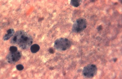 Negri bodies in nervous tissue (rabies diagnosis)