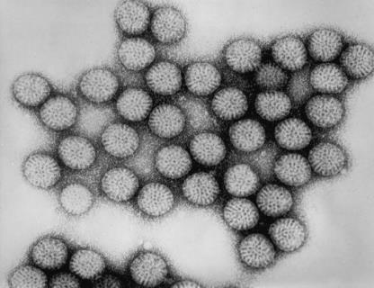 Rotavirus particles under electron microscope