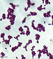 Gram stain of Staphylococcus aureus