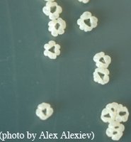 Distinctive Streptomyces colony morphology