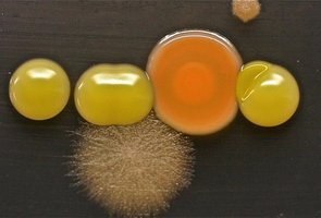Bacterial and fungal colonies growing on an agar plate