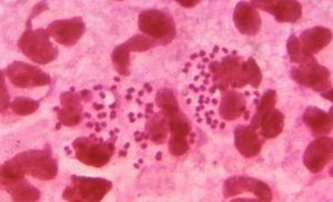 Gram stain of Neisseria species