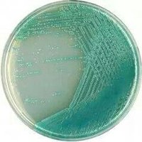 Pseudomonas aeruginosa colonies on agar plate