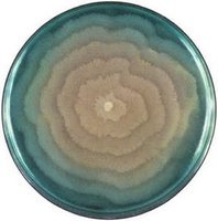 Proteus species showing swarming motility on agar plate