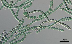 Filamentous cyanobacteria (Anabaena) under microscope