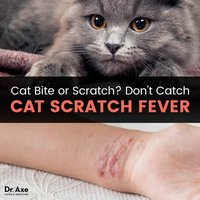 Cat-scratch disease: papule and cat