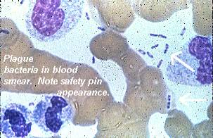 Plague bacteria in blood smear