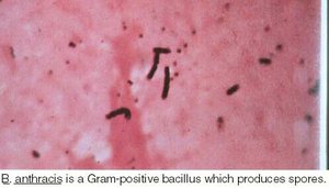 Bacillus anthracis gram stain