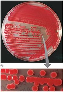 Colony morphology examples