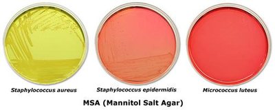 MSA (Mannitol Salt Agar) with different bacteria