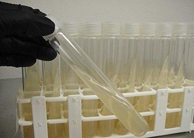 Agar slants (solid media)