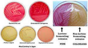 MacConkey Agar showing lactose fermenting and non-fermenting colonies
