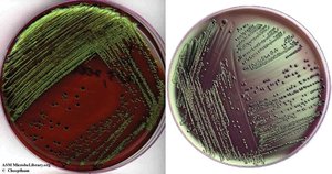 Eosin Methylene Blue Agar with green metallic sheen colonies