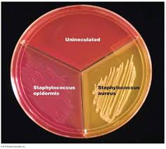 Mannitol Salt Agar with Staphylococcus aureus and Staphylococcus epidermidis
