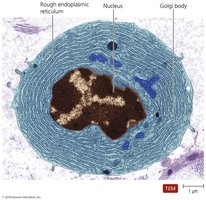 Plasma cell