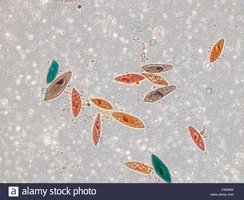 Protozoa and bacteria