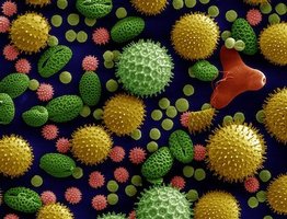 Microscopic image of diverse microbes