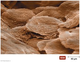 SEM image of keratinized epithelial cells in the skin