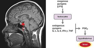 Diagram of fever induction via pyrogens and hypothalamus