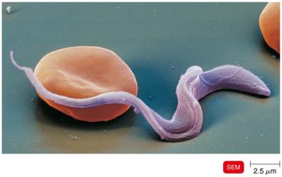 Trypanosoma cruzi, the cause of Chagas disease