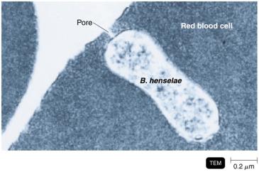 Bartonella henselae within a red blood cell