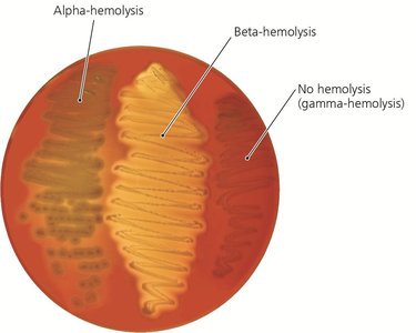 Blood agar as differential medium