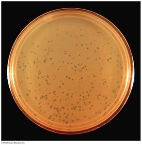 Viral plaques formed by bacteriophages