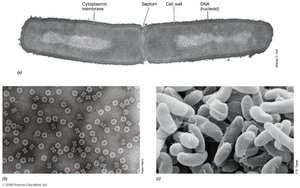 Comparison of light and electron microscopy images