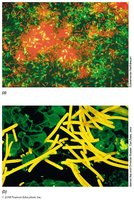 Confocal scanning laser microscopy images
