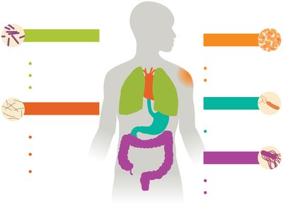 Oxygen tolerance and microbe location in human body