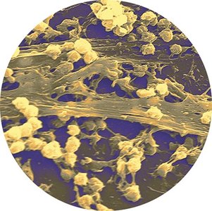 Biofilm under microscope