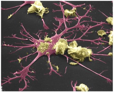 Dendritic cell with antigen-presenting function