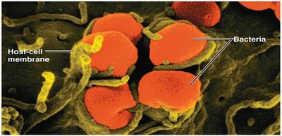 Scanning electron micrograph of bacteria attaching to a host cell membrane