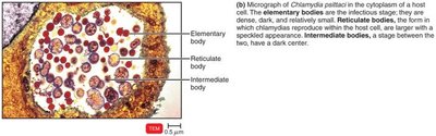 Micrograph of Chlamydia in host cell showing elementary, reticulate, and intermediate bodies