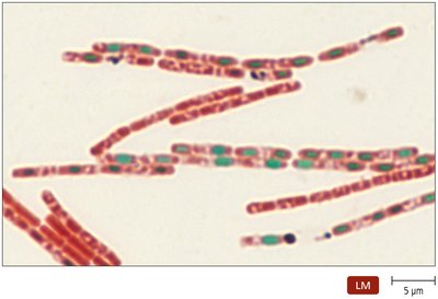 Endospore stain showing green endospores and red vegetative cells