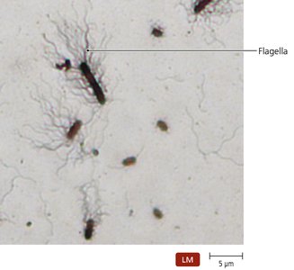 Flagellar stain showing bacterial flagella