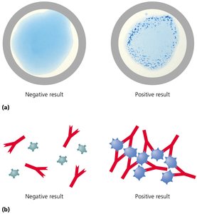 Serological test showing positive and negative results