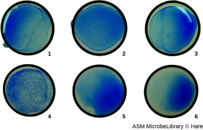 Serological agglutination test