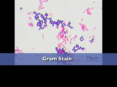 Gram stain showing purple and pink bacteria