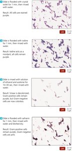 Steps of Gram staining with results