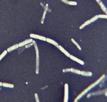Gram stain results: Gram-positive cocci and Gram-negative bacilli