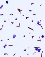 Bacterial flagella under microscope