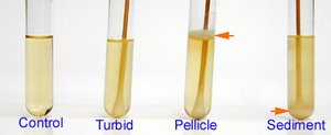 Broth tube examples: control, turbid, pellicle, sediment