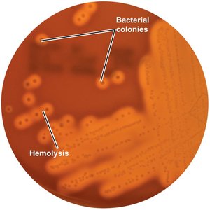 Mannitol salt agar differentiating Staphylococcus species