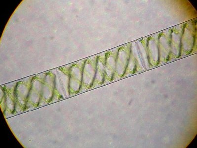 Algae Spirogyra under microscope