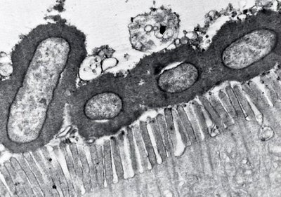 Electron micrograph of bacteria adhering to epithelial cells