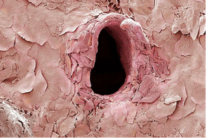 Hole in skin after needle puncture